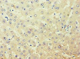 AKR7A3 Antibody