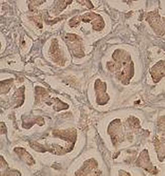 AKR7A3 Rabbit Polyclonal Antibody