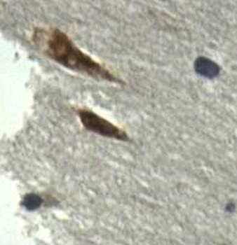 AKR7L Rabbit Polyclonal Antibody