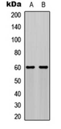 AKT (phospho-S473) antibody
