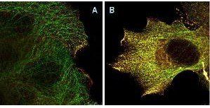 Akt (phospho-S473) antibody