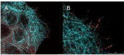 Akt (phospho-S473) antibody