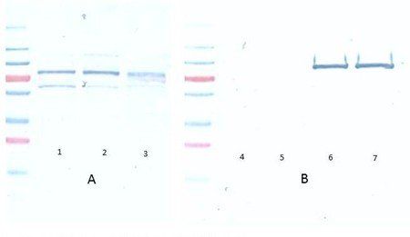 Akt (phospho-S473) antibody