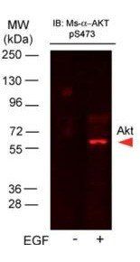 Akt (phospho-S473) antibody