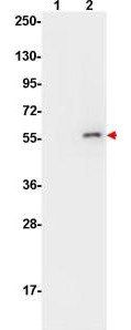 Akt (phospho-S473) antibody