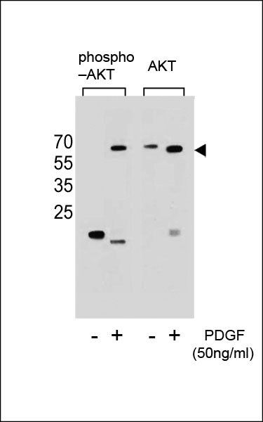 AKT (phospho-Ser473) antibody