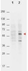 Akt (phospho-T308) antibody