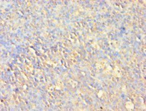 AKT1 Antibody