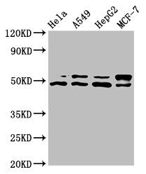 AKT1 Antibody