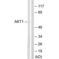 AKT1 (Ab-124) Antibody