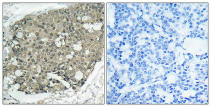 AKT1 (Ab-308) Antibody