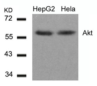AKT1 (Ab-308) antibody