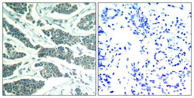 AKT1/AKT2/AKT3 (Ab-315/316/312) Antibody