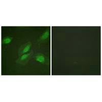 AKT1 (Ab-326) Antibody