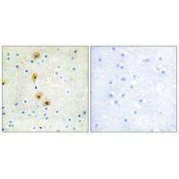 AKT1 (Ab-326) Antibody