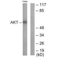AKT1 (Ab-326) antibody