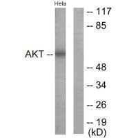 AKT1 (Ab-326) Antibody