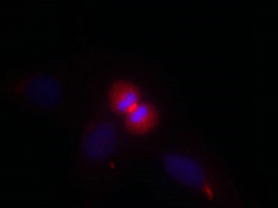 AKT1 (Ab-450) Antibody