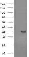AKT1 Antibody