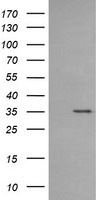 AKT1 Antibody