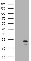 AKT1 Antibody