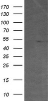 AKT1 Antibody