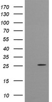 AKT1 Antibody