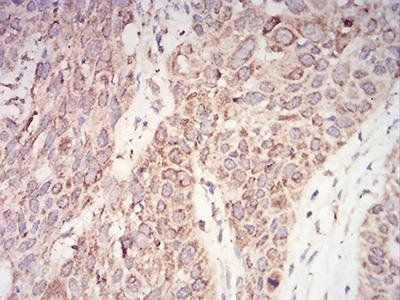 AKT1 Antibody