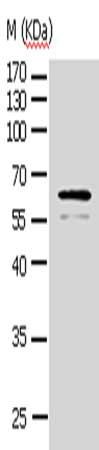 AKT1 Antibody
