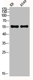 AKT1/AKT2/AKT3 Antibody