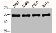 AKT1/AKT2/AKT3 Antibody