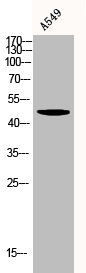 AKT1/AKT2/AKT3 Antibody