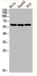 AKT1 Antibody
