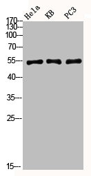 AKT1 Antibody