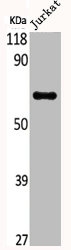 AKT1 Antibody