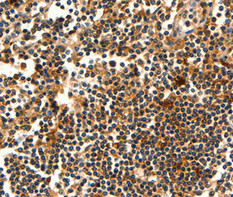 AKT1 Antibody