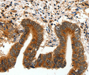 AKT1 Antibody