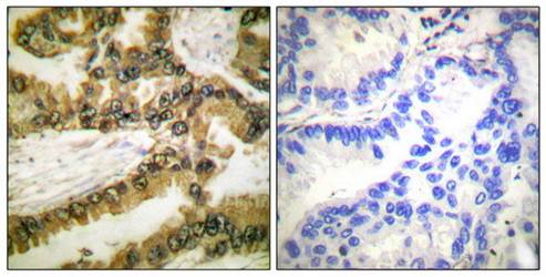 Akt1 (Phospho-Thr450) Antibody