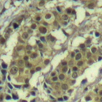 AKT1 (Ab-450) Antibody