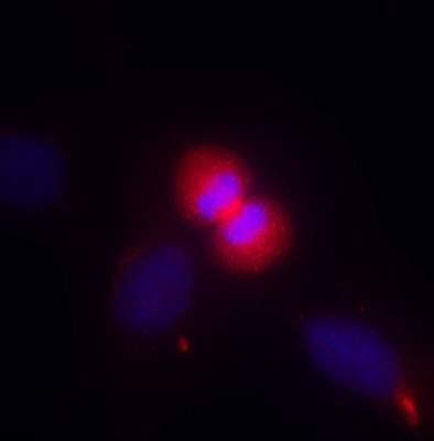 AKT1 (Ab-450) Antibody