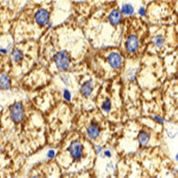 Akt1 Antibody