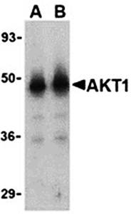 Akt1 Antibody
