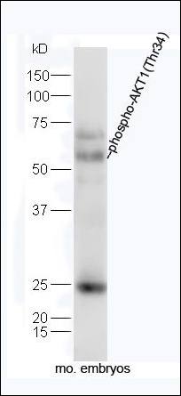 AKT1 (phospho-Thr34) antibody