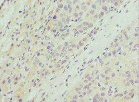 AKT1S1 Antibody