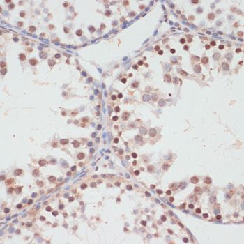 AKT1S1 (Phospho-T246) antibody