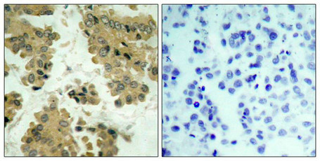 AKT2 (Ab-474) Antibody
