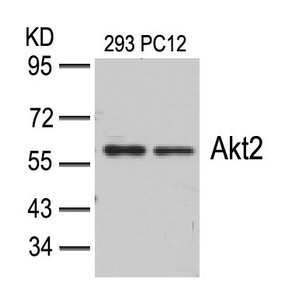 AKT2 (Ab-474) Antibody