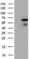 AKT2 Antibody