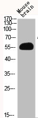 AKT2 Antibody
