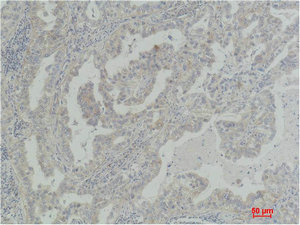 AKT2 Antibody